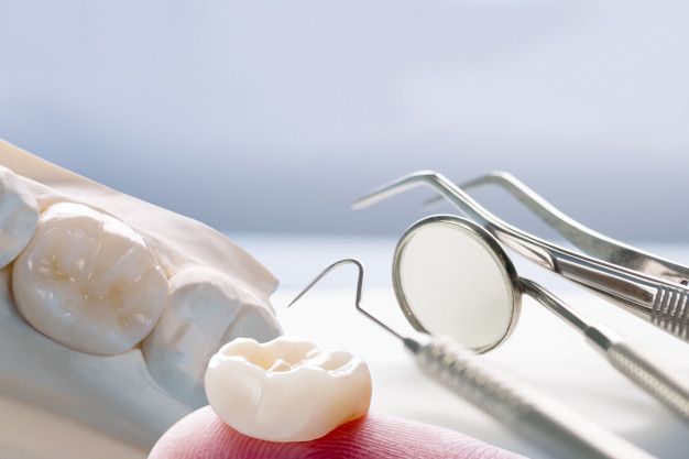 Same Day Dental Crowns: Convenient and Efficient Restorative Dentistry